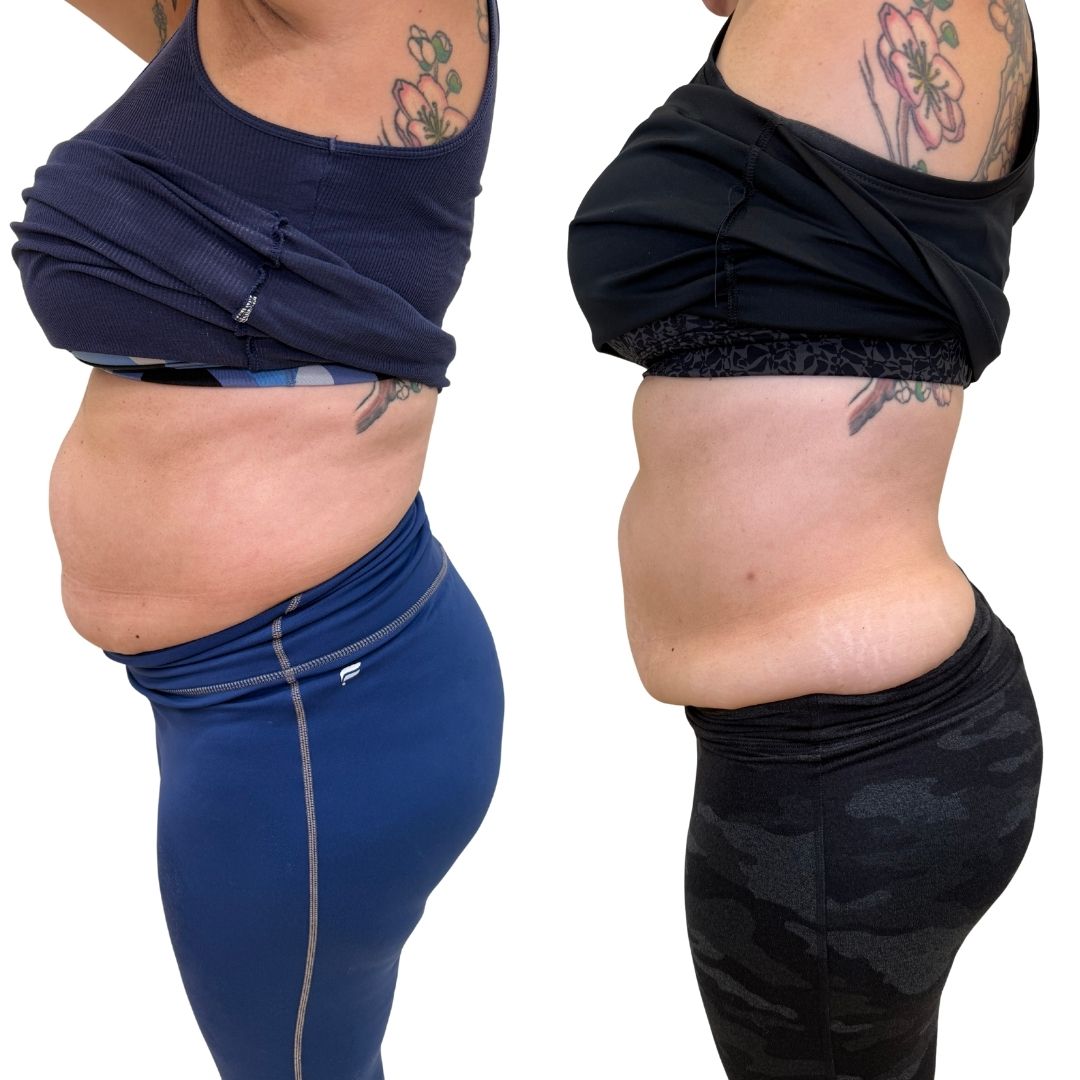 1.5months side
