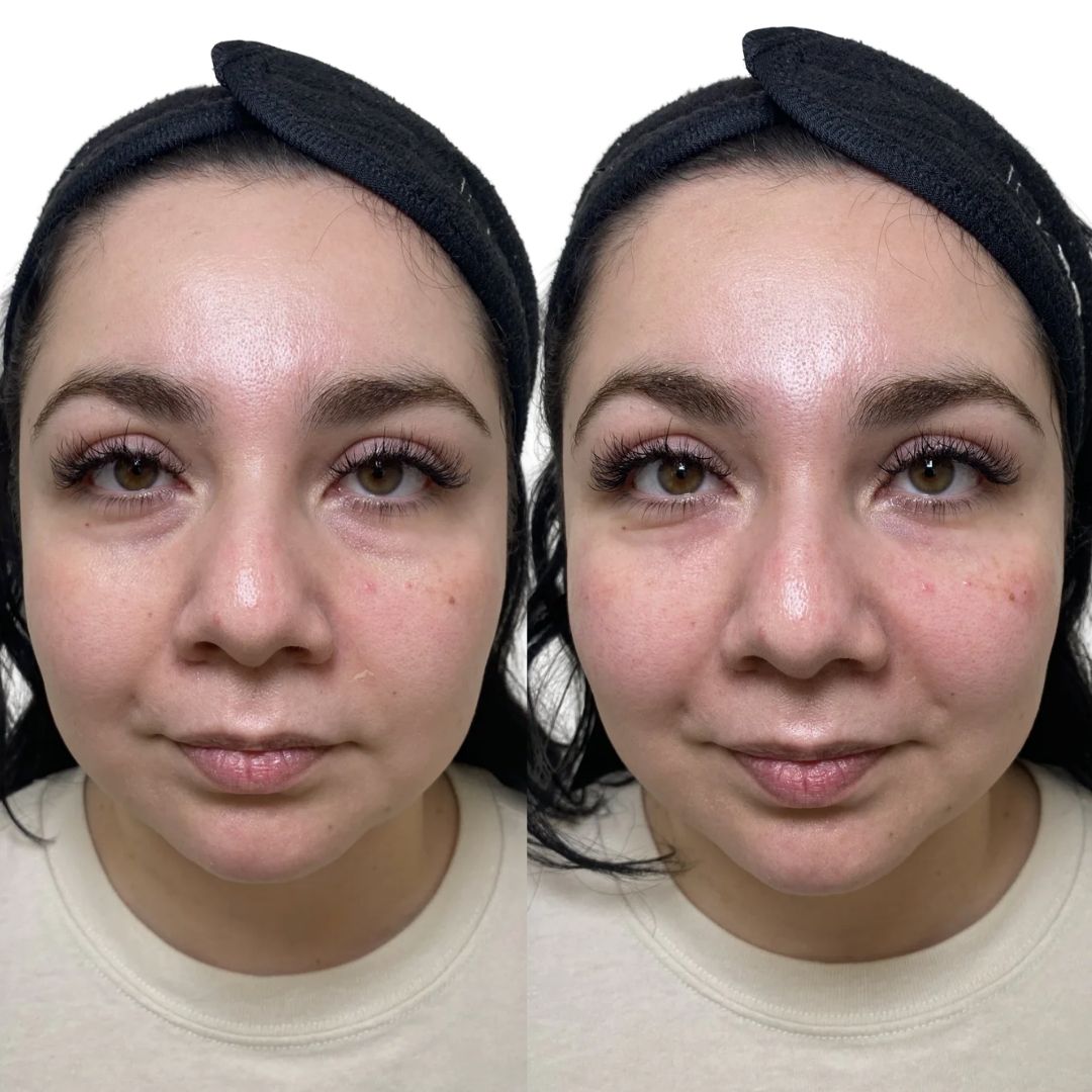 EZ-Gel (1_3 session) (2)