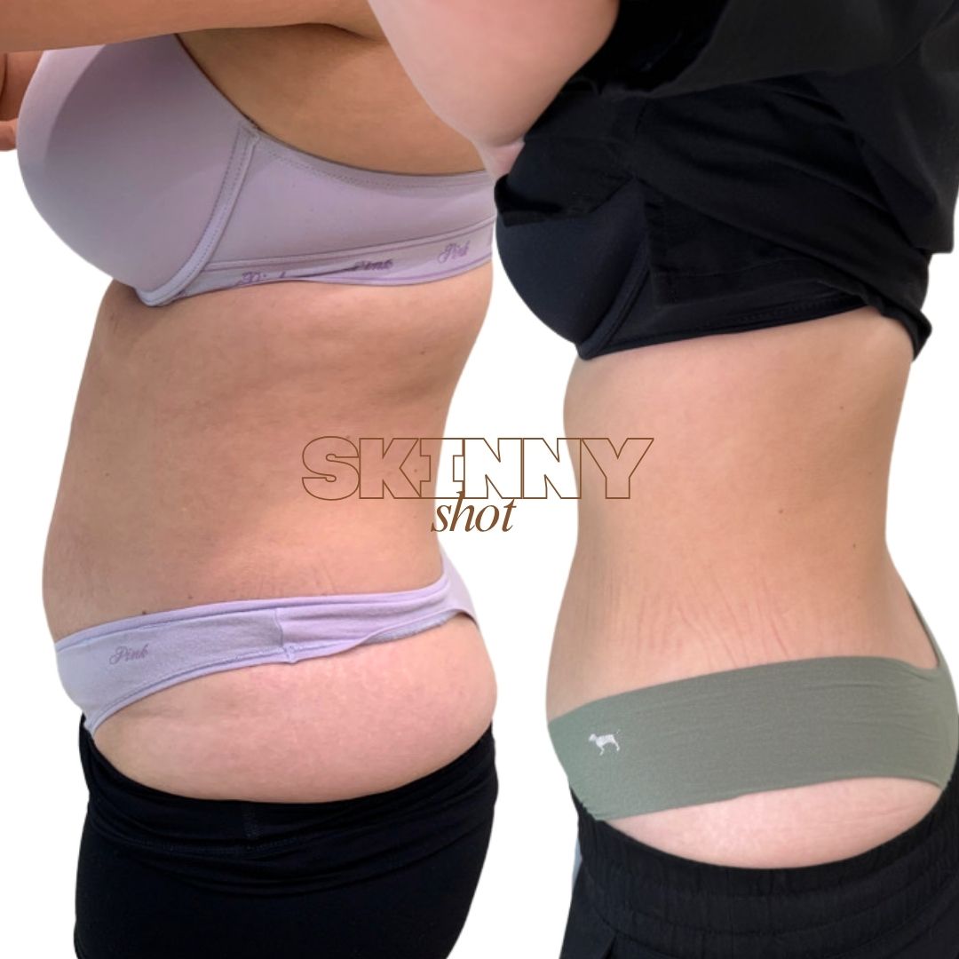 Skinny - 3 months