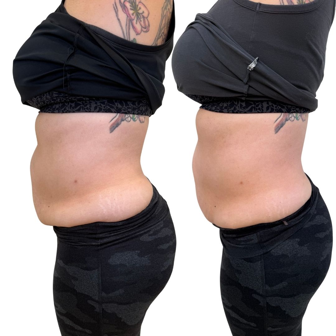 Skinny Bootcamp 1.5months (2)