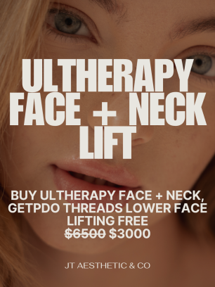 FACE LIFTING- ULTHERAPY W PDO