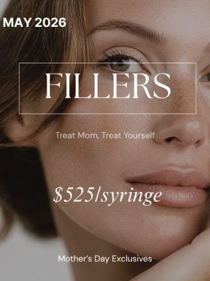 May- Fillers