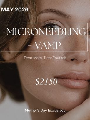May- Microneedling