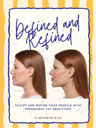 kybella